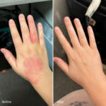 Crema Dermatitis & Piel Sana – Alivia picor, enrojecimiento y descamación 50ml - Imagen 9
