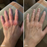 Crema Dermatitis & Piel Sana – Alivia picor, enrojecimiento y descamación 50ml - Imagen 8